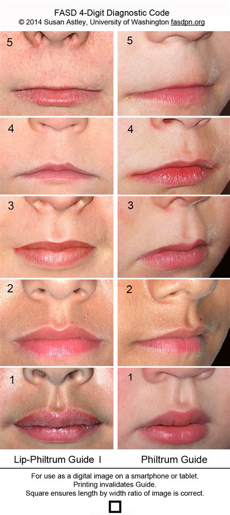 are thin lips genetic symptoms