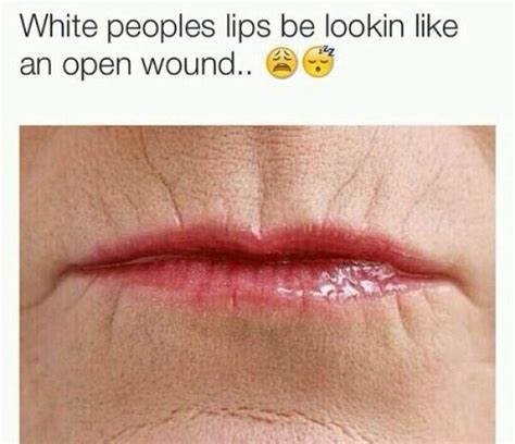 are thin lips unattractive