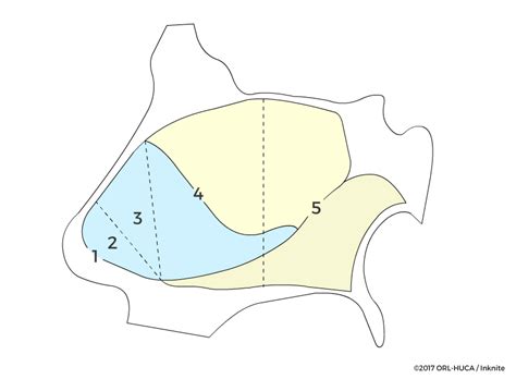 Areas De Cottle