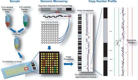 Array Comparative Genomic Hybridization