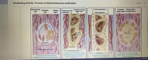 Art Ranking Activity Process Of Intramembranous Ossification