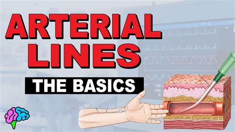 Arterial Lines For Dummies
