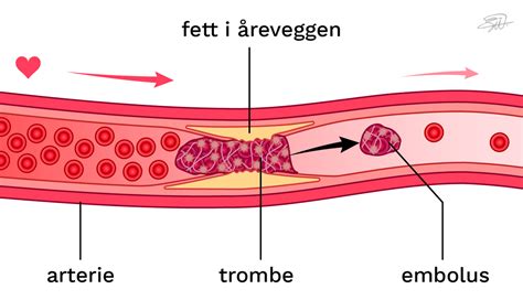 arteriell blod