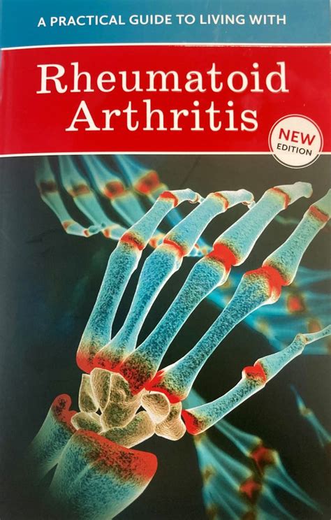 arthritis a practical guide to getting on with yo
