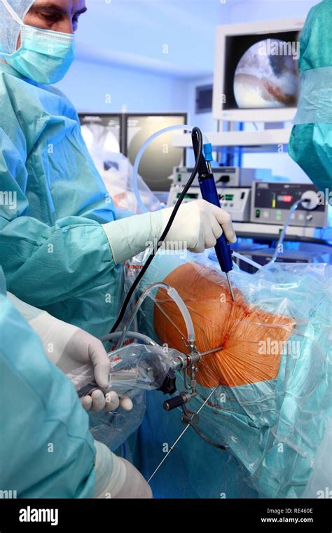 arthroscopy and endoscopy of the foot and ankle p