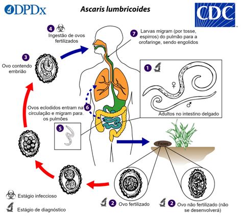 ascaridiase