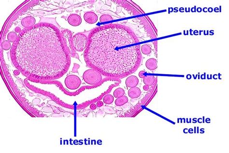 Ascaris Cross Section Labeled