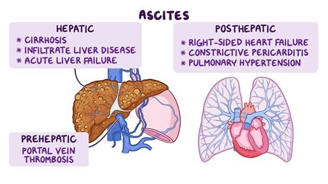 ascites behandling