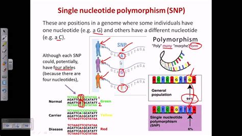 Download Association Of Single Nucleotide Polymorphisms In A 