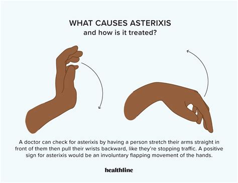Asterixis Liver Flap