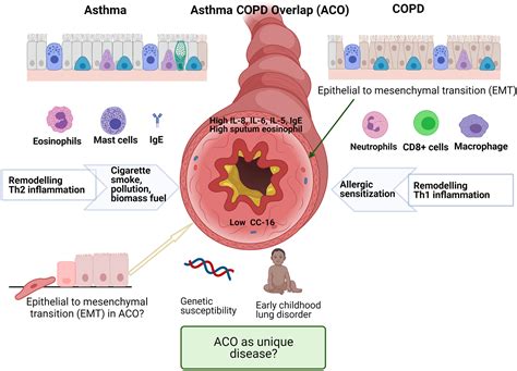 Asthma And Copd Basic Mechanisms And Clinical Management