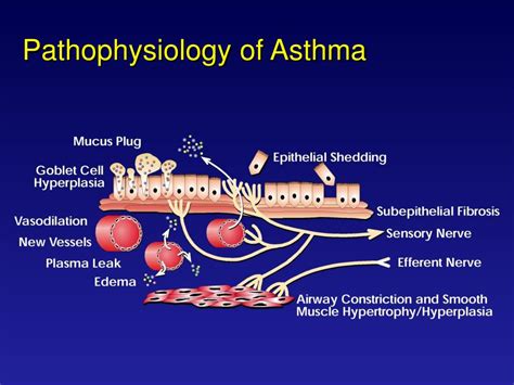 asthma pathophysiology