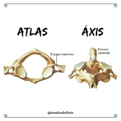 Atlas E Axis