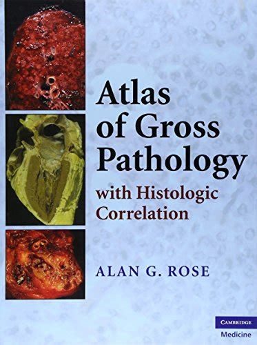 atlas of gross pathology with histologic correlation