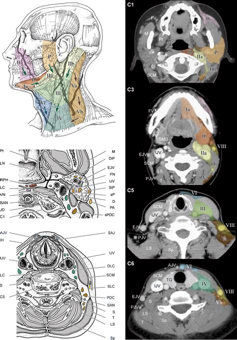 Download Atlas For Delineation Of The Lymph Node Regions For 