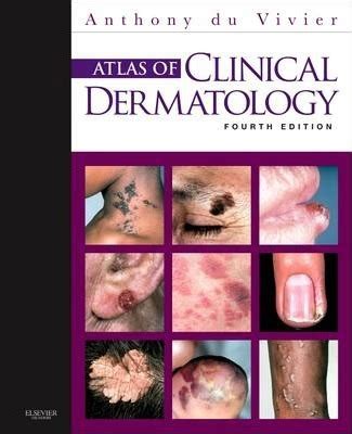 Read Atlas Of Clinical Dermatology 4E 4Th Fourth Edition By Du Vivier Md Frcp Anthony Published By Saunders 2012 