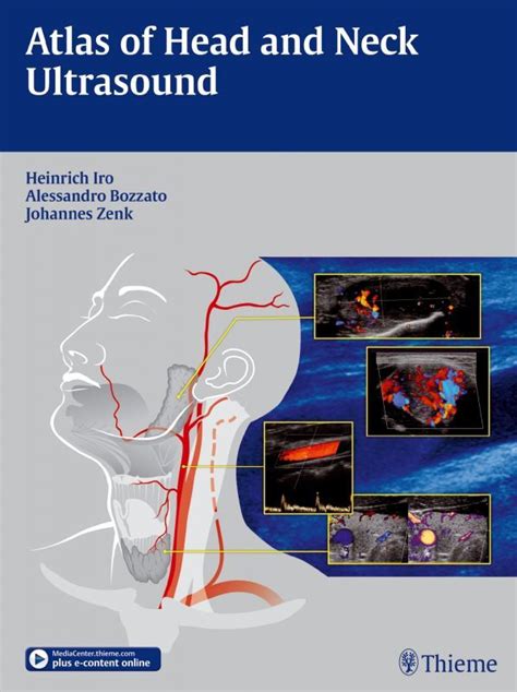 Full Download Atlas Of Head And Neck Ultrasound E Books 