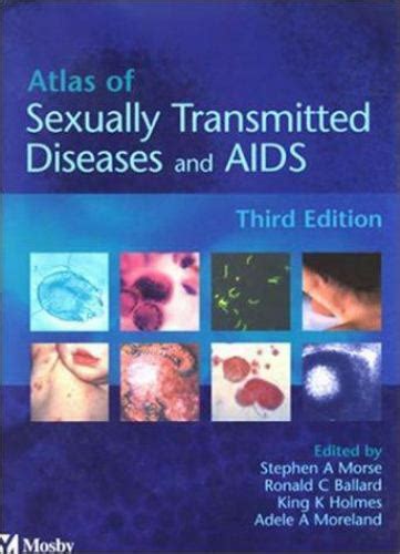 Full Download Atlas Of Sexually Transmitted Diseases And Aids 3E 