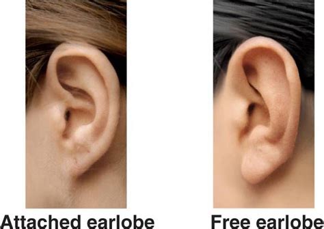 Attached Earlobes