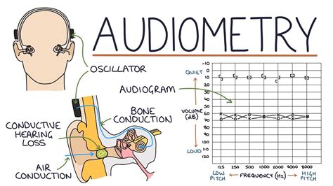 Read Audiometry And Hearing Loss Examples Chime Health 