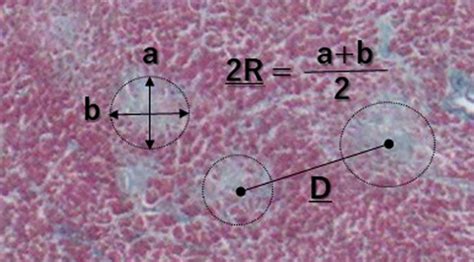 Autopsy Scars Reference