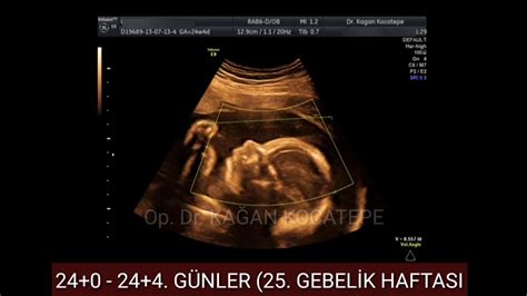 aylık bebek kaç haftalık oluyor? - 24-25 haftalar bittiğinde 6 ay bitmiştir.