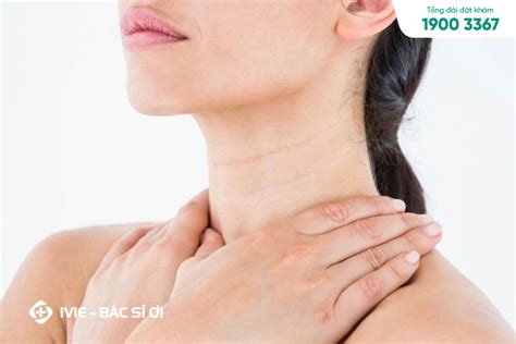 bướu cổ | Bnh bu c Nguyn nhn triu chng