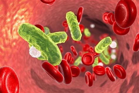 Bacteremia