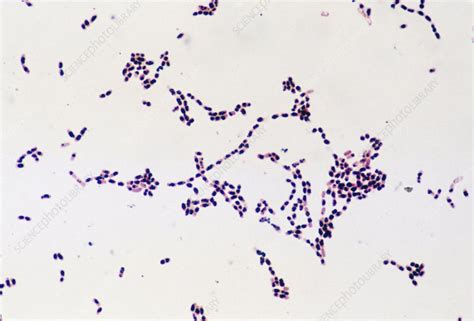 Bacteria B Cereus