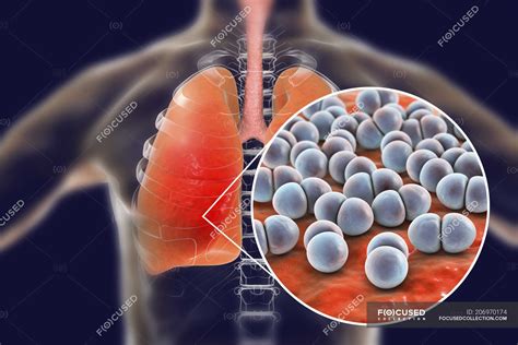 Bacteria Streptococcus Pneumoniae