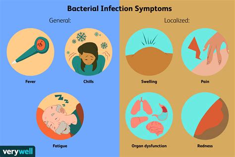 bacterial infection