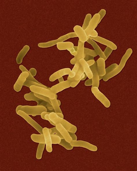 bakteri shigella dysenteriae