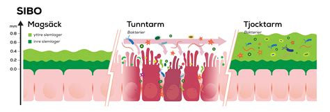 bakterier i tunntarmen