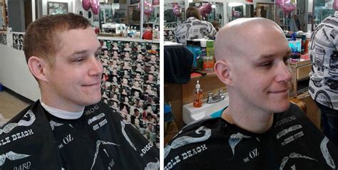 bald to the bone