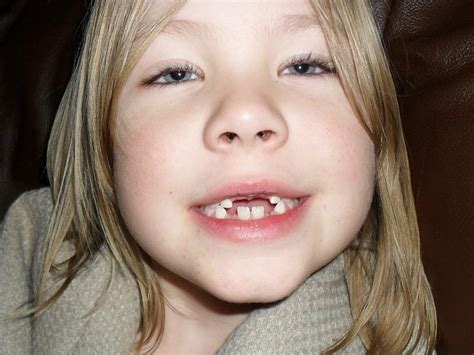 barn bruna tänder