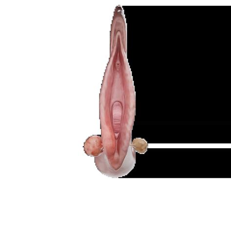 bartolinit återkommande