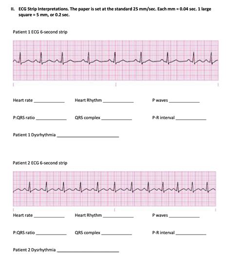 Download Basic Ecg Interpretation Practice Test Answers 