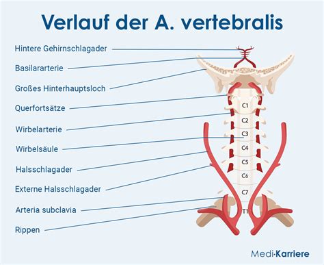basilaris typ migrän