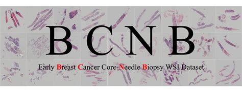 bcnb | BCNB Thu nhp Investingcom