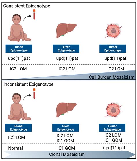 beckwith wiedemann syndrome cancer