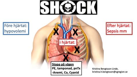 behandla chock