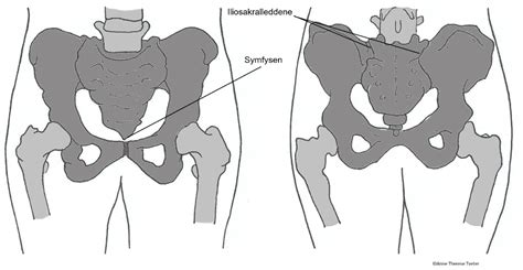bekkenløsning symptom