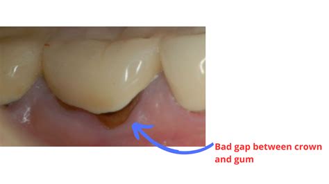 Belladonna Gap Tooth