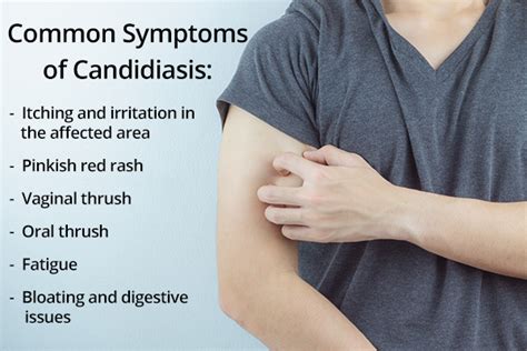 Belly Button Candidiasis