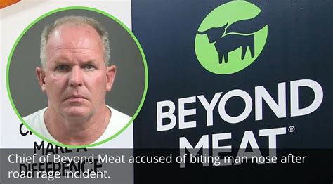 Beyond Meat chief accused of biting man's nose in road rage 
