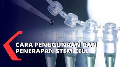 biaya stem cell di rscm