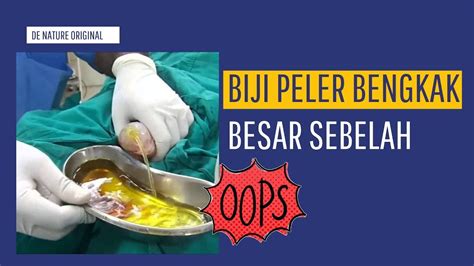 biji peler | Biji Peler Terbaru 2024 Cepat Tangguh Puluhan