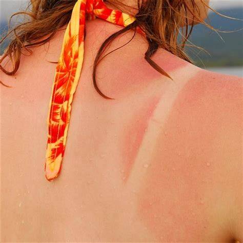 bikini tan lines nude