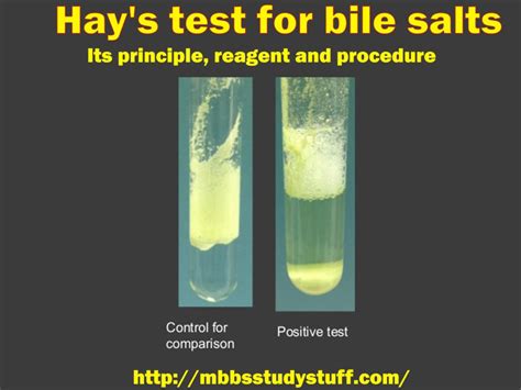 Bile Salts Test