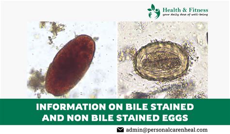 Bile Stained Eggs